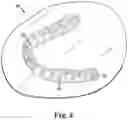 Fig. 04 - Laser cutting