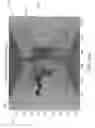 Fig. 16 - Systems and methods for performing occlusion detection