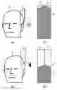 Fig. 01 - System and method for treating a part of a body