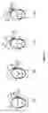 Fig. 07 - System and method for treating a part of a body