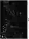 Fig. 05 - MICRONEEDLE ARRAYS FORMED FROM POLYMER FILMS