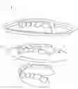 Fig. 01 - DEVICE FOR FABRICATING A DENTAL BRACE