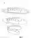 Fig. 02 - DEVICE FOR FABRICATING A DENTAL BRACE