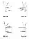 Fig. 06 - External sensor kit for injection molding apparatus and methods of use