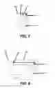 Fig. 08 - External sensor kit for injection molding apparatus and methods of use