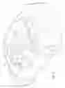 Fig. 02 - Vehicle airbag