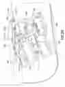 Fig. 08 - Body mounted shrinking landing gear