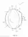 Fig. 07 - Container with closure arrangement restricting spillage