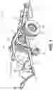 Fig. 02 - Trailer stabilizer and restraint