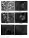 Fig. 09 - MULTIPOTENT ADULT STEM CELLS: CHARACTERIZATION AND USE