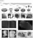Fig. 02 - Three dimensional heterogeneously differentiated tissue culture