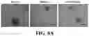 Fig. 15 - IMMUNOPROTECTION OF PANCREATIC ISLETS
