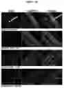 Fig. 25 - SNAP25 antisense oligonucleotides