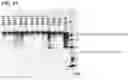 Fig. 22 - Gene therapy for treating Wilson's disease
