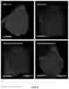Fig. 07 - OPTIMIZED STRATEGY FOR EXON SKIPPING MODIFICATIONS USING CRISPR/CAS9 WITH TRIPLE GUIDE SEQUENCES