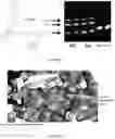 Fig. 02 - Nucleotide triphosphate immobilised on a support and their use in nucleic acid synthesis