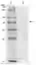 Fig. 01 - NOVEL USES OF CATALYTIC PROTEIN