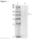 Fig. 02 - NOVEL USES OF CATALYTIC PROTEIN