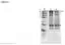 Fig. 07 - NOVEL USES OF CATALYTIC PROTEIN