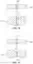Fig. 16 - Method of tape embroidery