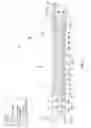 Fig. 03 - Systems, apparatus and methods for collecting and separating floating debris and water from a body of water