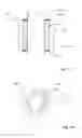 Fig. 12 - Method for vibration damping of and vibration damper assembly for semi-submerged or submerged structure