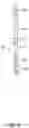 Fig. 03 - Auto-adjustable directional drilling apparatus and method