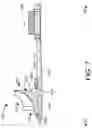 Fig. 08 - Axial thrust loading mitigation in a turbocharger