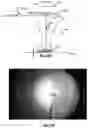 Fig. 09 - Device and method for observing the radiation backscattered by an object
