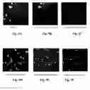 Fig. 20 - Image analysis and measurement of biological samples