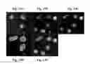 Fig. 24 - Image analysis and measurement of biological samples