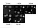 Fig. 25 - Image analysis and measurement of biological samples