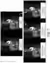 Fig. 06 - Time-of-flight resolution-adaptive image regularization and filtering in positron emission tomography