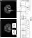 Fig. 07 - Time-of-flight resolution-adaptive image regularization and filtering in positron emission tomography