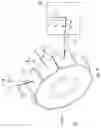 Fig. 09 - Portable surface finishing device based on coherent light source