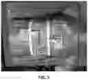 Fig. 06 - Live 3D holographic guidance and navigation for performing interventional procedures