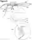 Fig. 06 - Wearable image manipulation and control system with high resolution micro-displays and dynamic opacity augmentation in augmented reality glasses