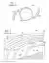 Fig. 02 - Diffractive trifocal lens