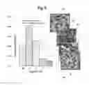Fig. 05 - Focus-weighted, machine learning disease classifier error prediction for microscope slide images