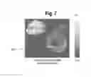 Fig. 07 - Focus-weighted, machine learning disease classifier error prediction for microscope slide images