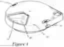 Fig. 02 - Position control of pet bowl
