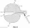 Fig. 07 - Braided Article of Headgear and Method of Making