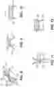 Fig. 07 - Article with intermediate side lacing system and method of lacing an article