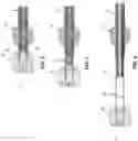 Fig. 03 - Method and apparatus for manipulating the side wall of a body lumen or body cavity so as to provide increased visualization of the same and/or increased access to the same, and/or for stabilizing instruments relative to the same