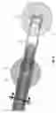 Fig. 04 - Method and apparatus for manipulating the side wall of a body lumen or body cavity so as to provide increased visualization of the same and/or increased access to the same, and/or for stabilizing instruments relative to the same