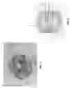 Fig. 06 - Method and apparatus for manipulating the side wall of a body lumen or body cavity so as to provide increased visualization of the same and/or increased access to the same, and/or for stabilizing instruments relative to the same