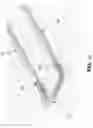 Fig. 08 - Method and apparatus for manipulating the side wall of a body lumen or body cavity so as to provide increased visualization of the same and/or increased access to the same, and/or for stabilizing instruments relative to the same