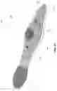 Fig. 29 - Method and apparatus for manipulating the side wall of a body lumen or body cavity so as to provide increased visualization of the same and/or increased access to the same, and/or for stabilizing instruments relative to the same