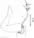 Fig. 70 - Method and apparatus for manipulating the side wall of a body lumen or body cavity so as to provide increased visualization of the same and/or increased access to the same, and/or for stabilizing instruments relative to the same