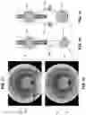 Fig. 77 - Method and apparatus for manipulating the side wall of a body lumen or body cavity so as to provide increased visualization of the same and/or increased access to the same, and/or for stabilizing instruments relative to the same